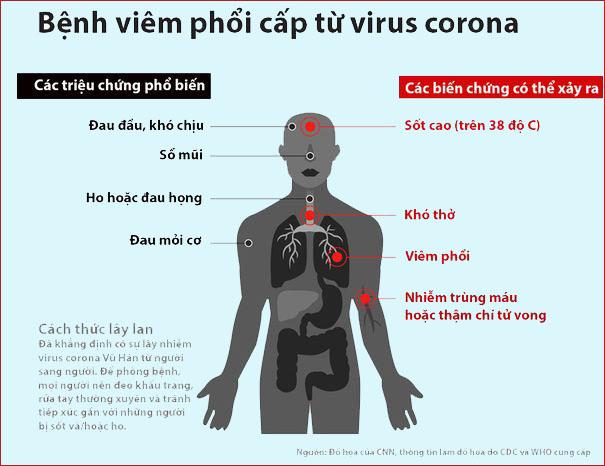 Kết quả hình ảnh cho triệu chứng corona